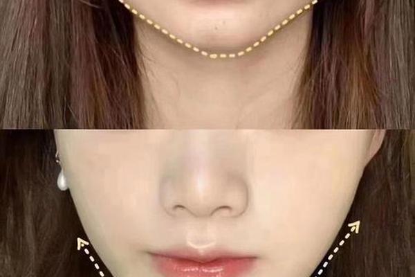 圆脸如何变成瓜子脸 怎样瘦脸变成瓜子脸