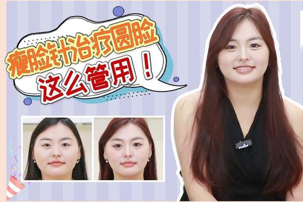 圆脸怎么养成圆脸;脸圆怎么瘦脸最有效